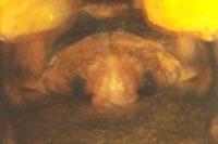 Tenuiphantes tenuis