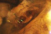 Theridiidae