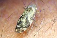 Philaenus spumarius