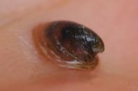 Ancylus fluviatilis