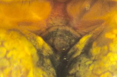 Araniella cucurbitina