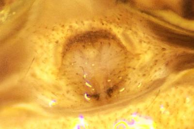 Xysticus ulmi